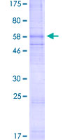 12.5% SDS-PAGE Stained with Coomassie Blue